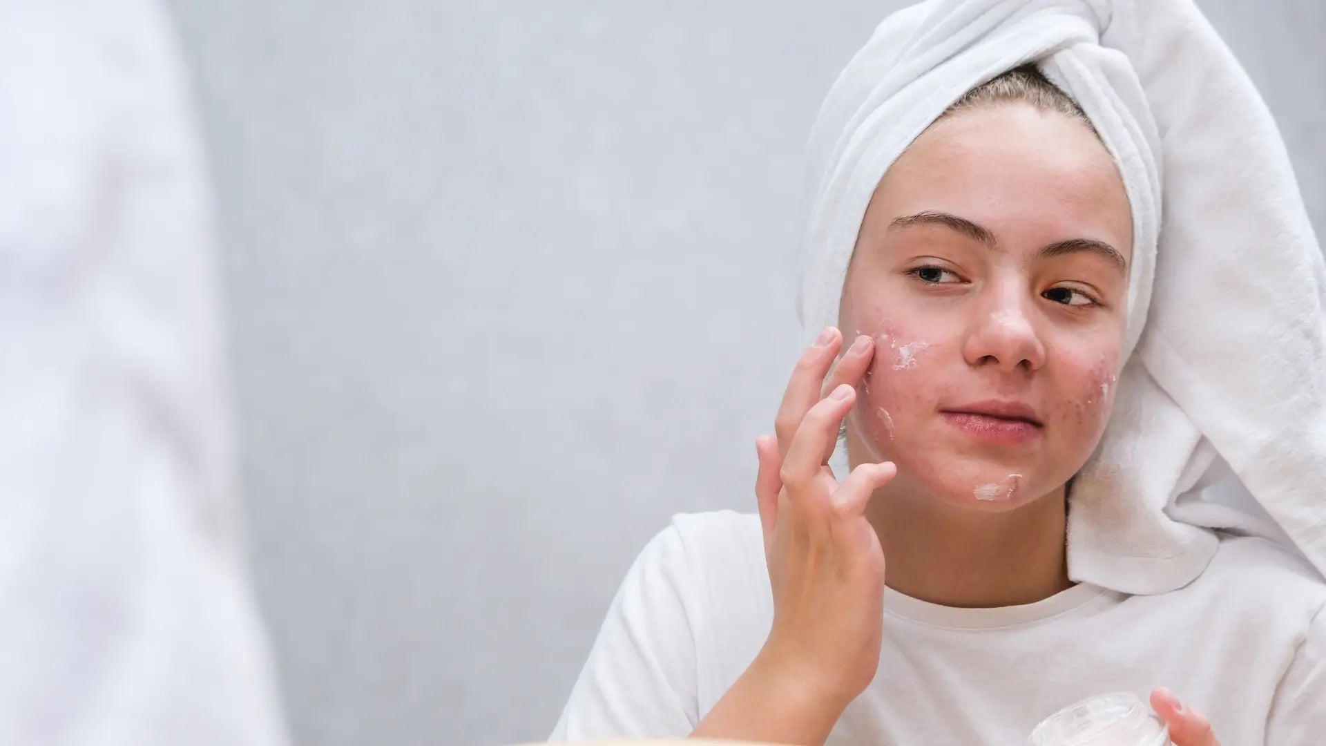 Bioderma Products For Acne-Prone Skincare Routine