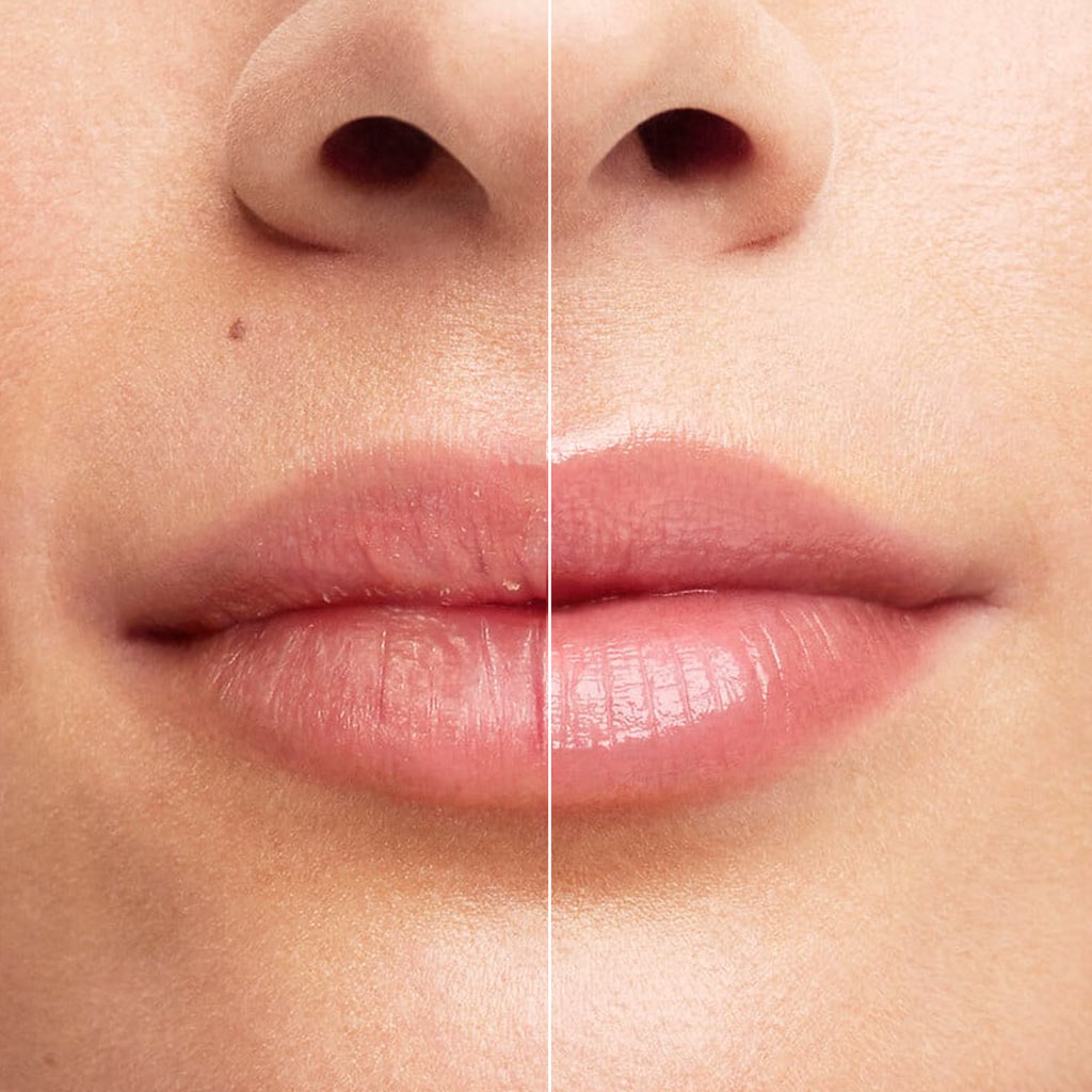 Cicabio Lip Repair 10ml